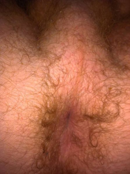 hairy woman anus