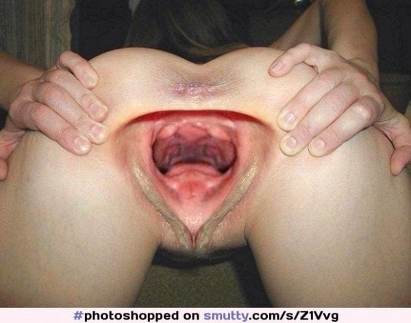 gape vulva