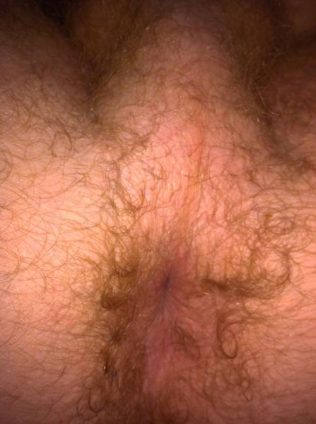 female ass hole close up
