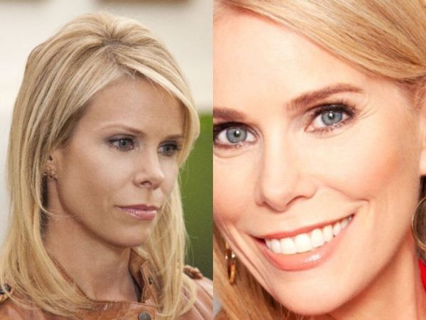 cheryl hines plastic surgery