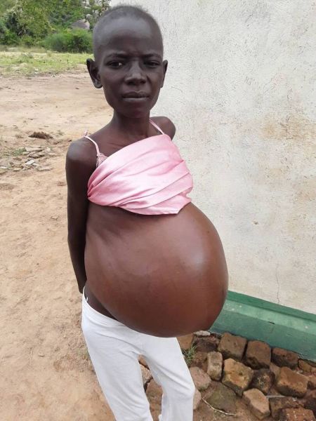 my pregnant