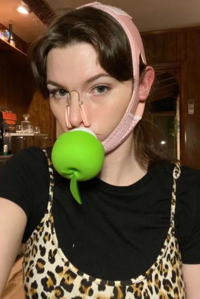 sara bareilles nose