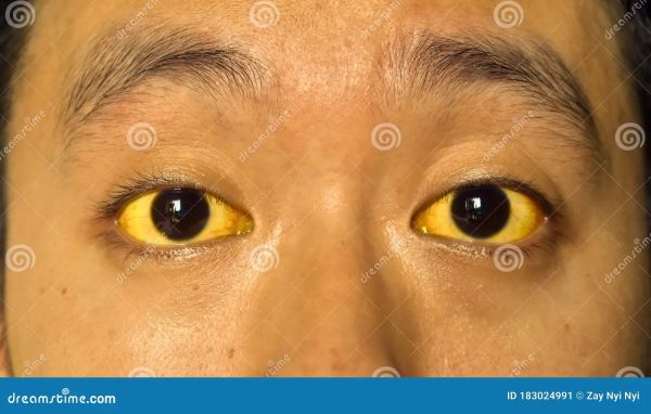 asian skin color types