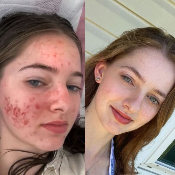 long hair before and after