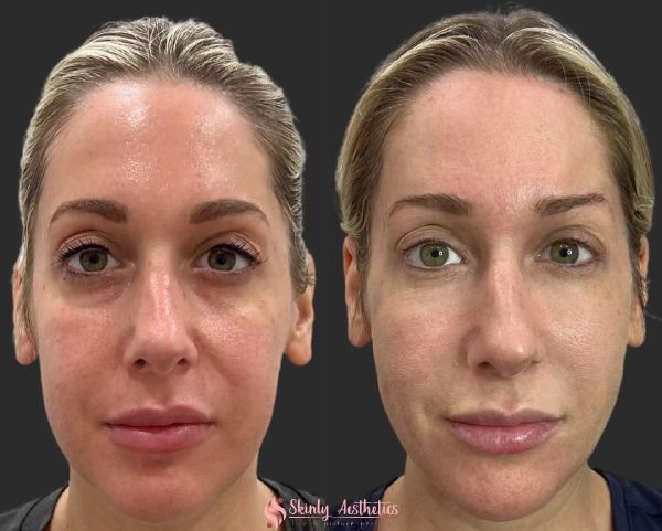 natural makeup before and after