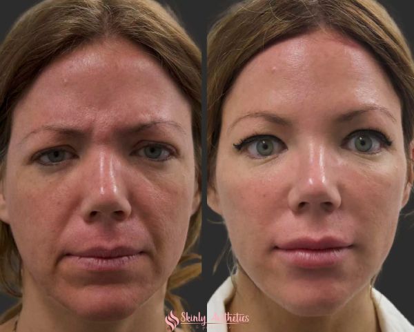 before and after professional makeup