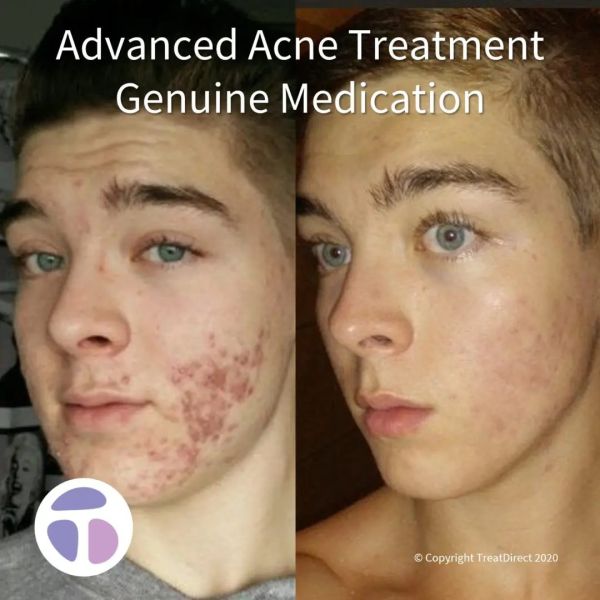 funny photoshop before and after