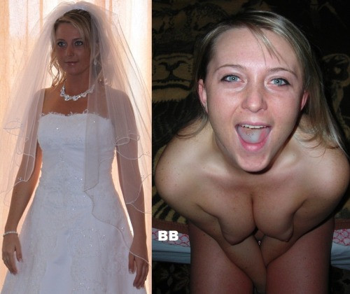 botched plastic surgery before and after body