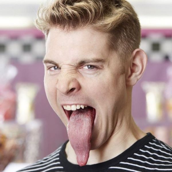 itchy gums