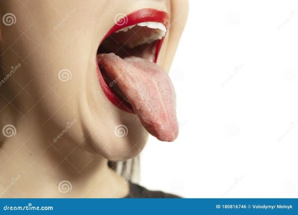 early tongue cancer
