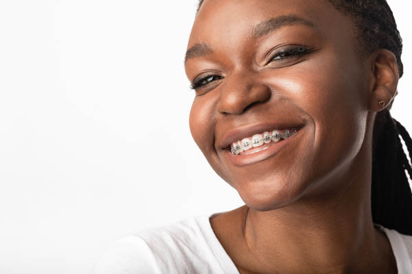 removable braces