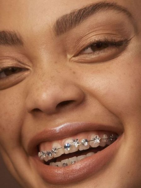 pink braces
