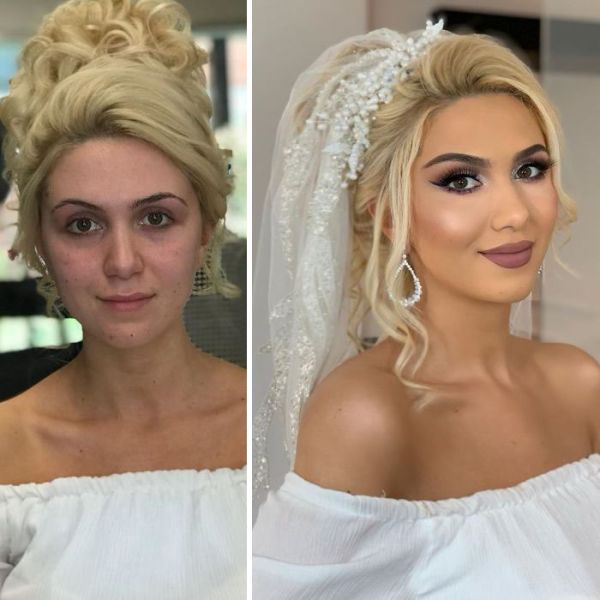 bridalplasty before and after