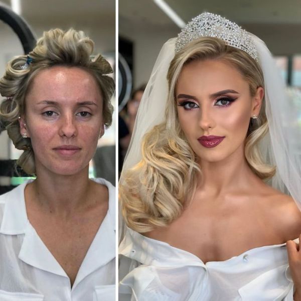 befoore and after dressed