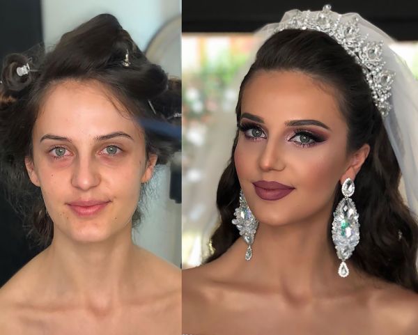 bridalplasty before and after