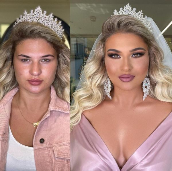 before e and after brides