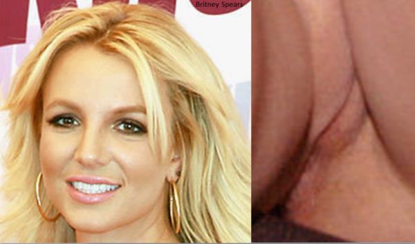britney spears lip injections