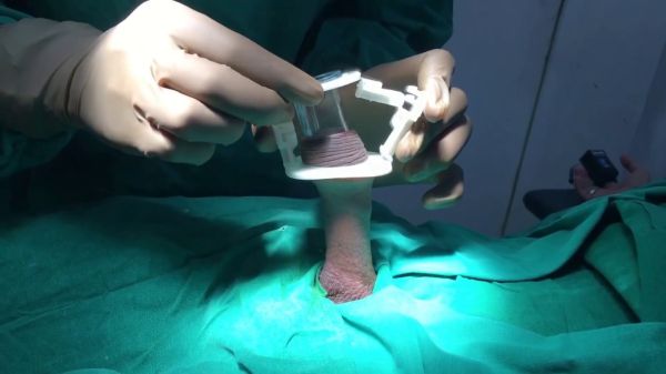 bulbourethral artery