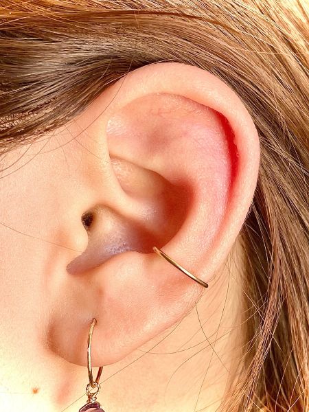 forward helix