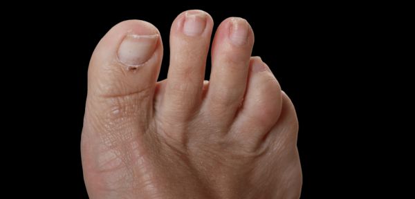 pedicure