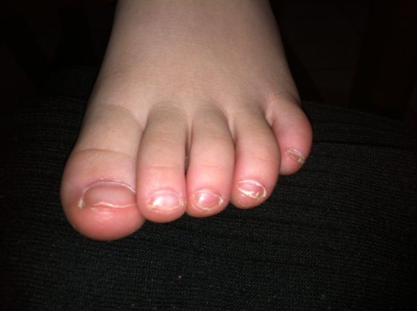 acrylic toe nails