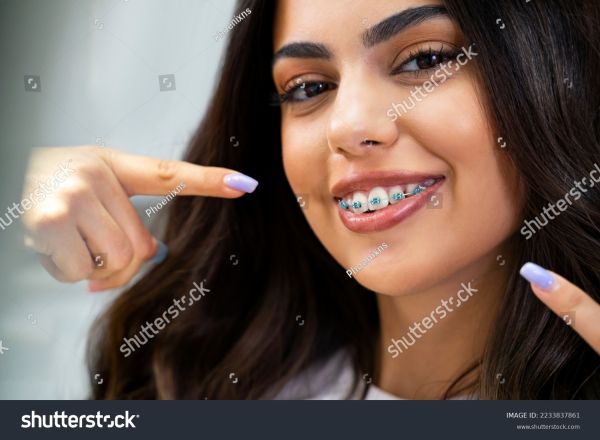 orthodontic braces