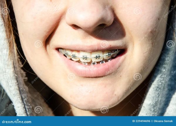 rubber band