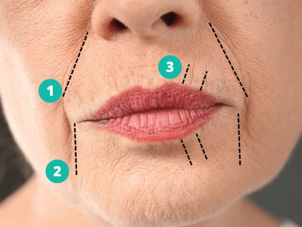 fillers for deep