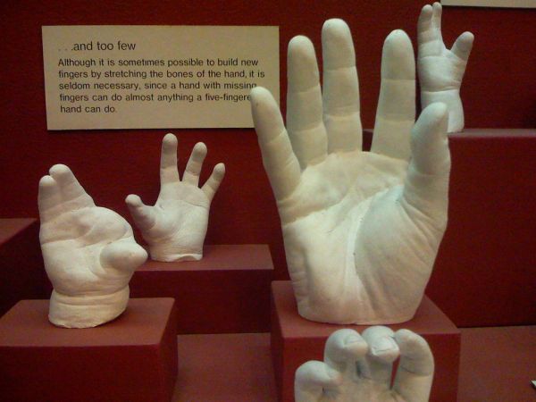deform thumb