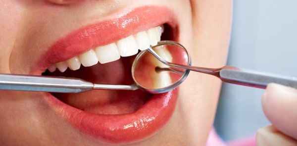 tooth filling
