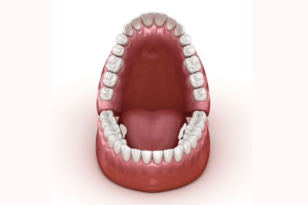 torus mandibularis surgery