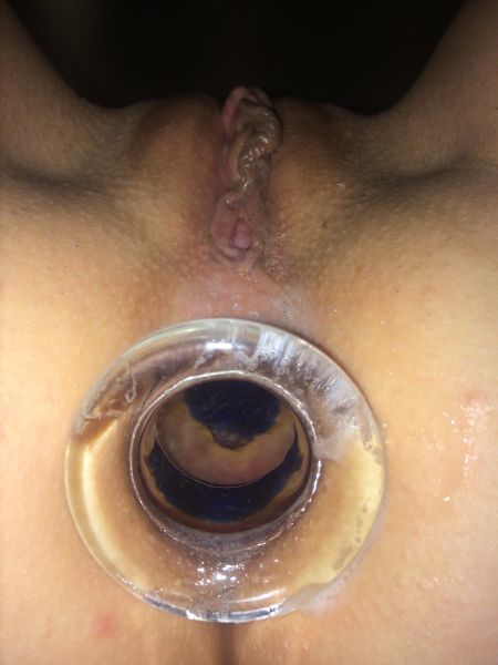gape