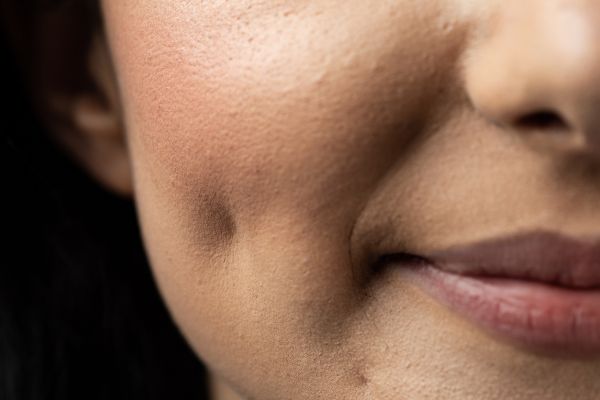 smile without