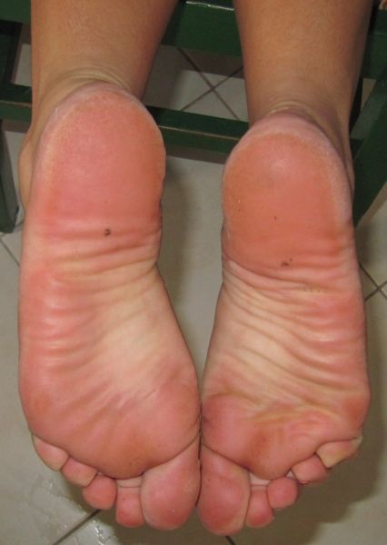funky wrinkles feet