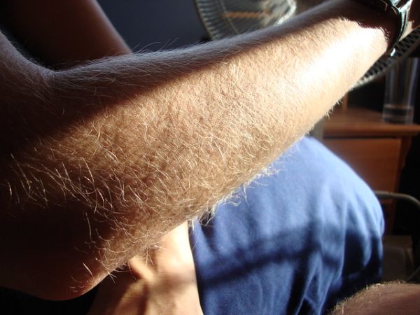 forearm fuzz