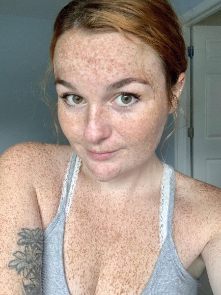 freckles asthetic