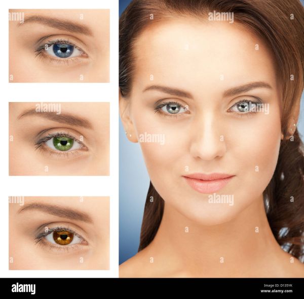 brown skin girl with rare colored eyes