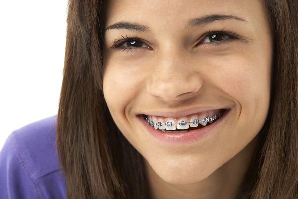 pink braces teeth