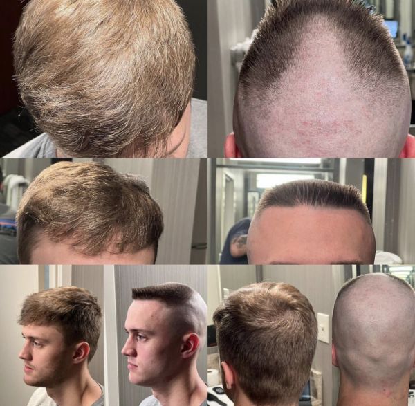 mixie side shave pictures