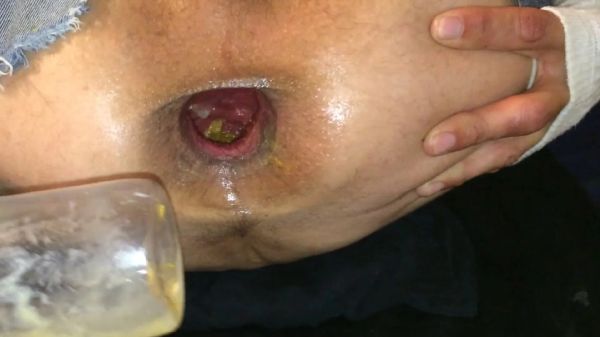 horny hairy ass