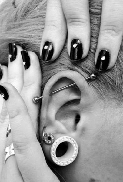 keloid