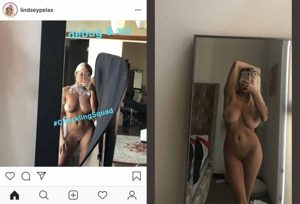 heidi pratt before and after surgery