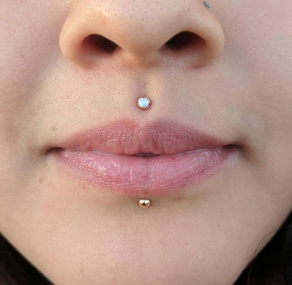 philtrum