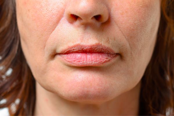 aging lips