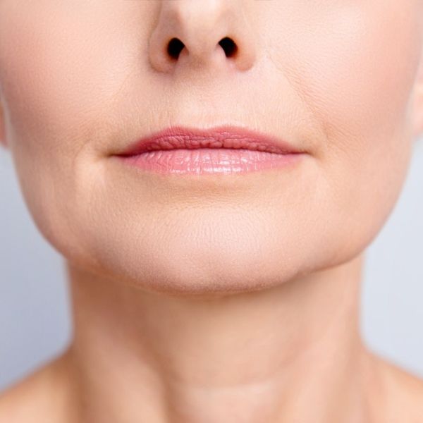 laser treatment on wrinkles above lip