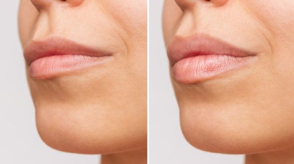 smokers lips