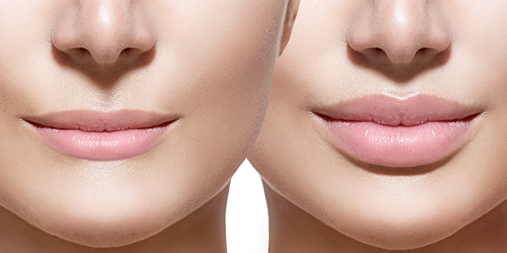 eye wrinkle treatment