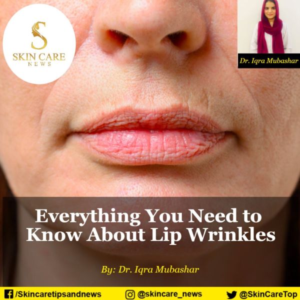 juvederm lip filler