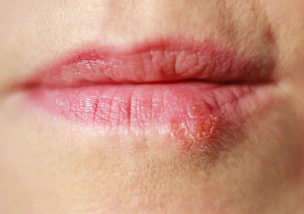above lip