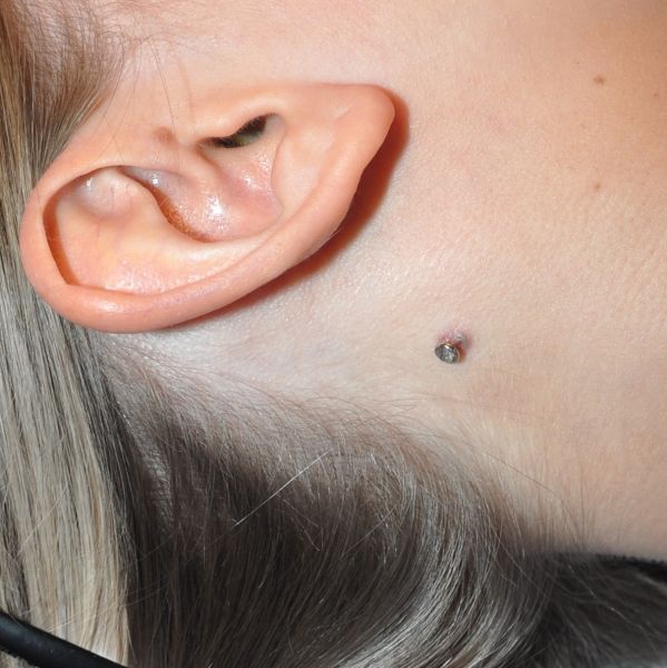 double ear